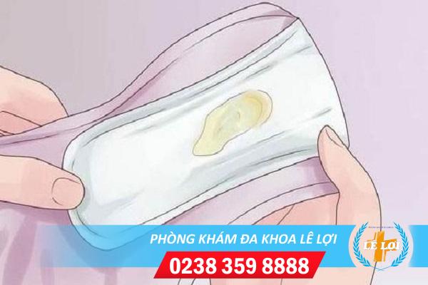 Âm đạo chảy mủ là bệnh gì?