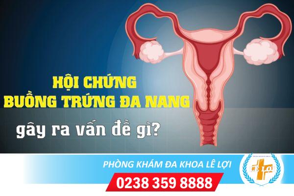 Phương pháp hỗ trợ trị bệnh đa nang buồng trứng hiệu quả