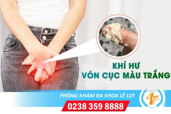 Khí hư vón cục trắng là dấu hiệu bệnh gì?