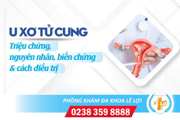 U xơ tử cung – Căn bệnh tiềm ẩn nhiều nguy hiểm