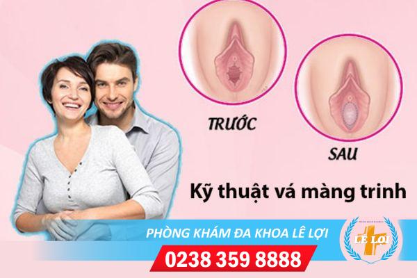 Địa Chỉ Vá Màng Trinh Uy Tín, Chất Lượng Tại Thành Phố Vinh