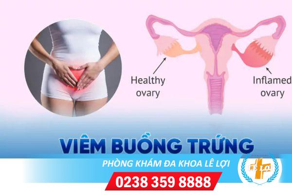 Tác hại khôn lường của viêm buồng trứng?