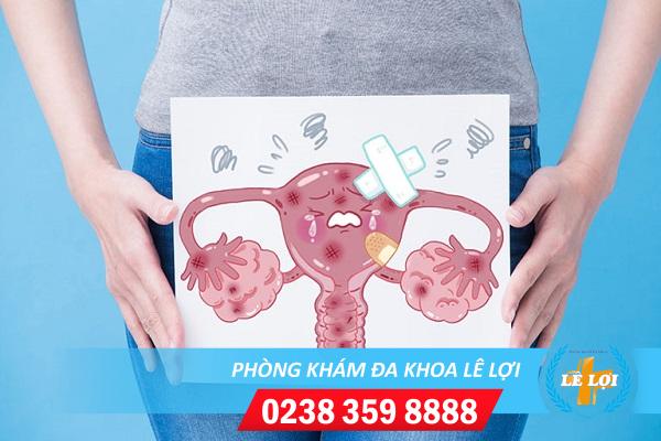 Các nguyên nhân viêm nội mạc tử cung bất ngờ bạn chưa biết