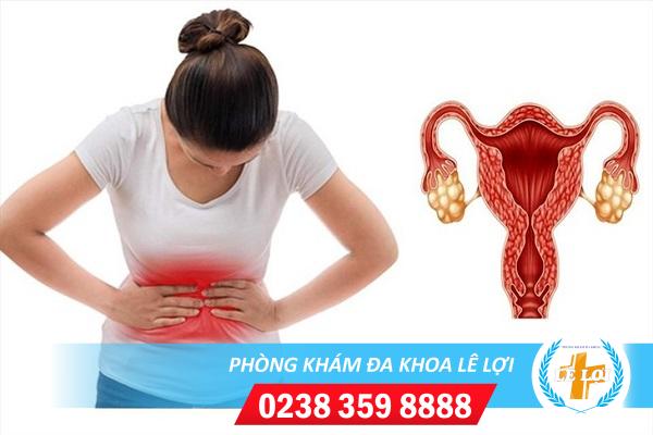 Dấu hiệu nhận biết bệnh đa nang buồng trứng