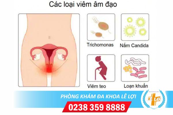 Những biểu hiện viêm âm đạo bạn không nên bỏ qua