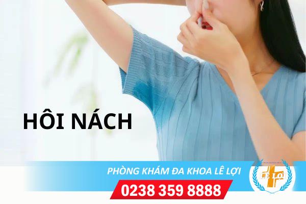 Bạn có biết cách hỗ trợ chữa bệnh hôi nách hiệu quả không