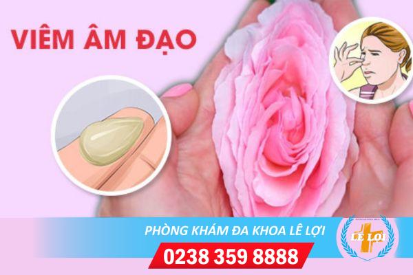 Viêm âm đạo – Tác hại, cách hỗ trợ điều trị uy tín tại Vinh