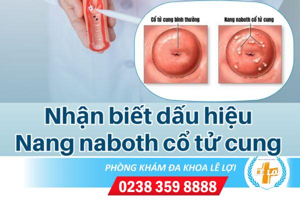 Cách nhận biết bệnh nang naboth cổ tử cung