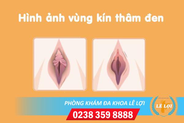 Làm hồng vùng kín – bí quyết làm tăng sự hứng khởi cho cuộc yêu