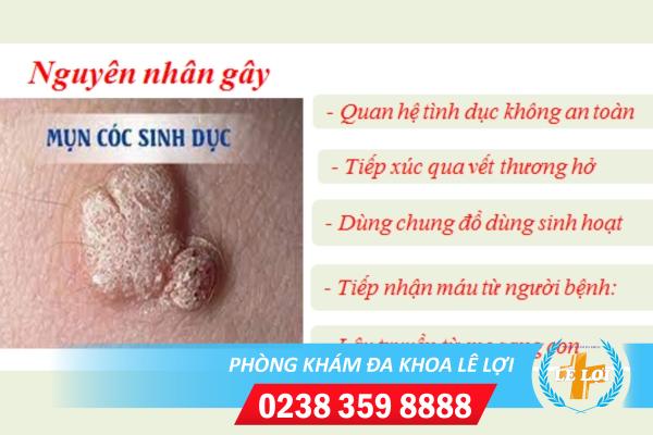 Mụn Cóc Sinh Dục Ở Nữ Có Nguy Hiểm Gì Không