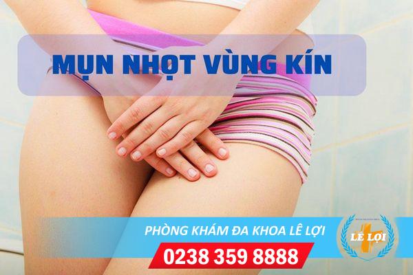 Triệu Chứng Nổi Mụn Nhọt Ở Vùng Kín Nữ Giới