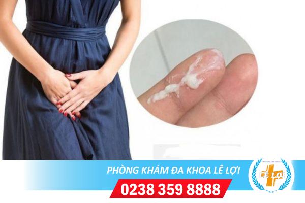 Khí hư là gì – Nhận biết khí hư bất thường