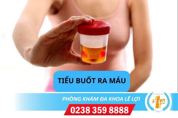 Địa chỉ chuyên khám và điều trị tiểu buốt ra máu