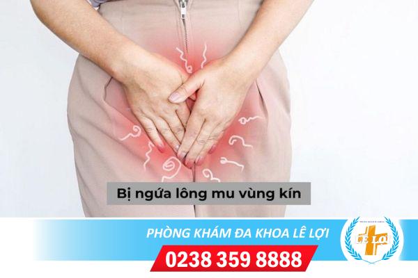 Cách trị ngứa lông vùng kín an toàn và hiệu quả