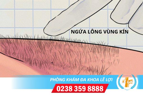 Ngứa và rụng lông vùng kín có ảnh hưởng gì không?