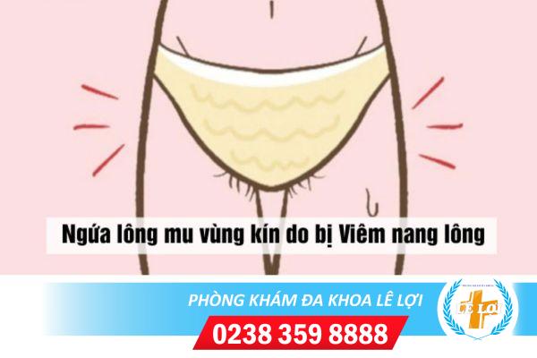 Tại sao bị ngứa lông vùng kín?