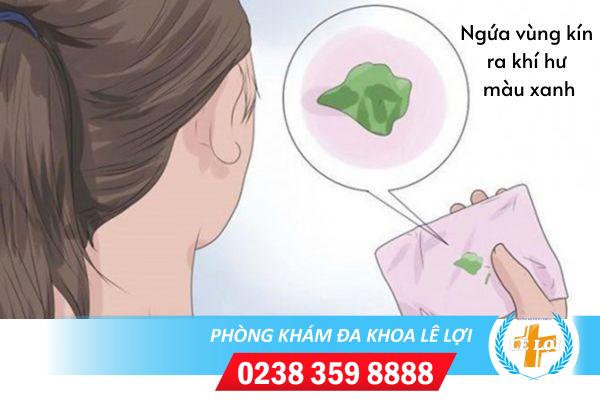 Ngứa vùng kín ra khí hư màu xanh là bị bệnh gì?