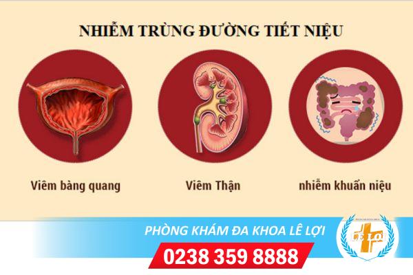 Thuốc trị nhiễm trùng, nhiễm khuẩn đường tiết niệu tại chuyên khoa