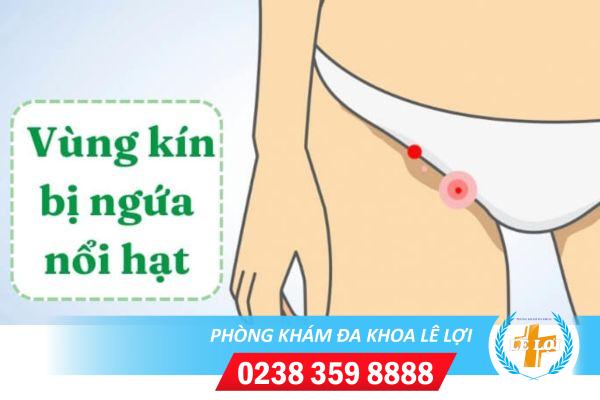 Ngứa nổi hạt vùng kín – Dấu hiệu bệnh lý phụ khoa nguy hiểm