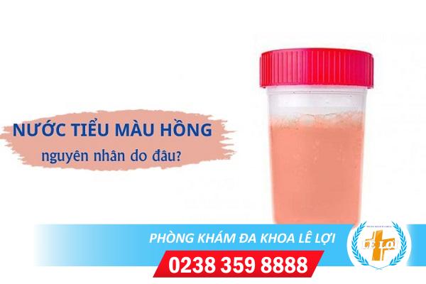 Đi Tiểu Ra Nước Màu Hồng Nhạt Là Bệnh Gì?