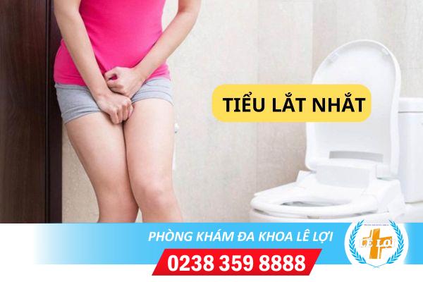 Thường Xuyên Mắc Tiểu Nhưng Lại Tiểu Ít, Tiểu Lắt Nhắt Thì Phải Làm Sao?