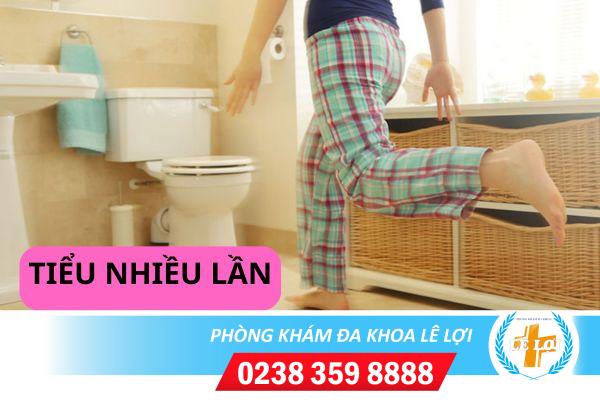 Khắc Phục Nỗi Ám Ảnh Đi Tiểu Nhiều Lần Trong Ngày Ở Nữ Giới