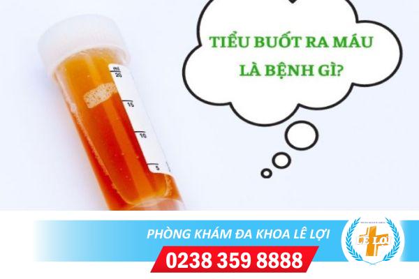 Tiểu Gắt Ra Máu Kèm Đau Bụng Dưới Là Do Đâu? Cách Điều Trị Như Thế Nào?