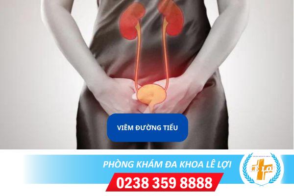 Thuốc Trị Viêm Đường Tiểu Hiệu Quả Hiện Nay