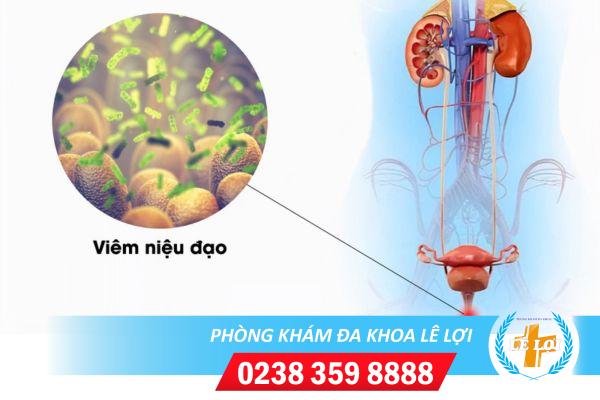 Viêm Niệu Đạo Khám Chữa Ở Đâu Hiệu Quả