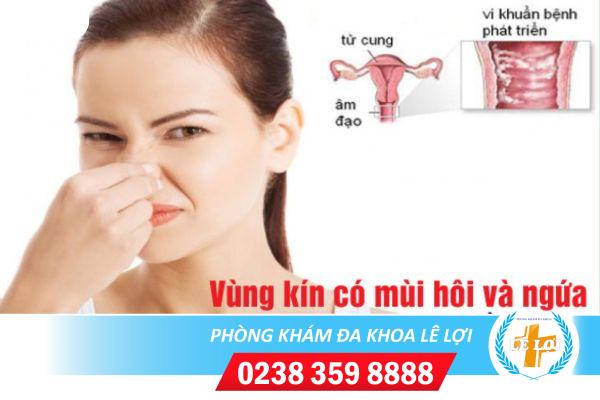 Cách trị hôi và ngứa vùng kín hiệu quả