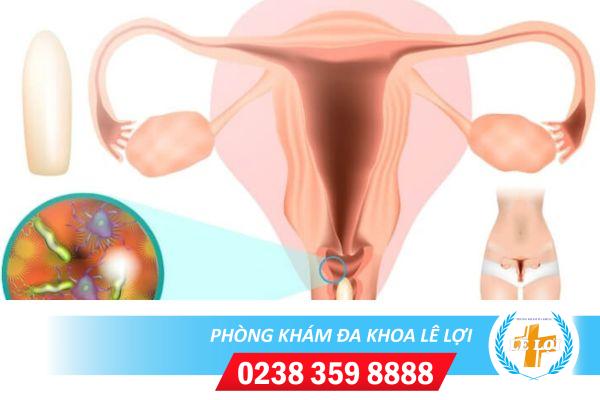 Vùng kín sưng ngứa phải làm sao?