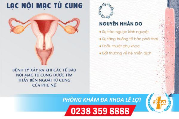 Lạc Nội Mạc Tử Cung Là Bệnh Gì