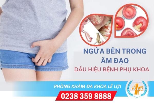 Ngứa bên trong âm đạo có ảnh hưởng gì không?