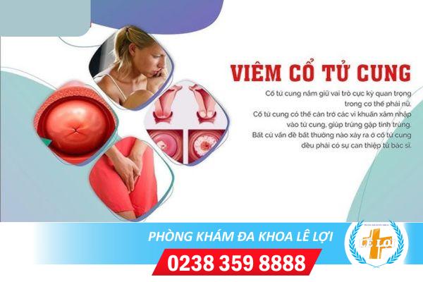 Viêm Cổ Tử Cung Và Các Triệu Chứng Thường Gặp