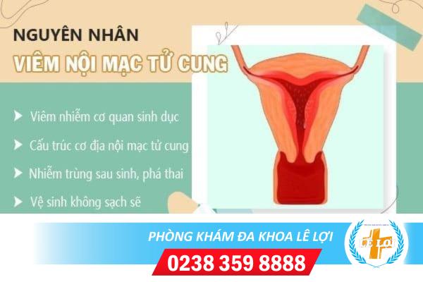 Những Điều Cần Biết Về Bệnh Viêm Nội Mạc Tử Cung Ở Nữ Giới