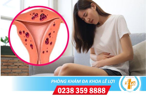 Dấu Hiệu Và Cách Trị Viêm Tử Cung Cho Nữ Giới