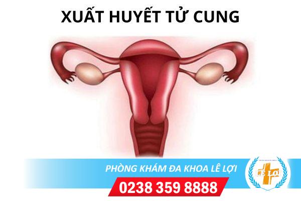 Những điều cần biết về xuất huyết, chảy máu tử cung bất thường