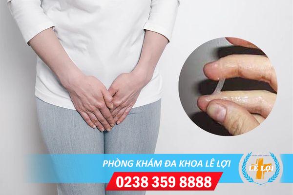 Huyết trắng đặc như lòng trắng trứng là biểu hiện bệnh gì?