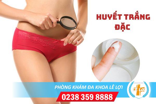 Chữa huyết trắng đặc màu trắng đục ở đâu hiệu quả?