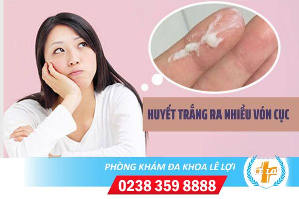 Chữa huyết trắng nhiều vón cục ở đâu hiệu quả?