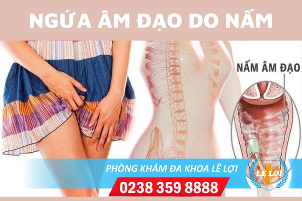 Nguyên nhân gây ngứa âm đạo do nấm