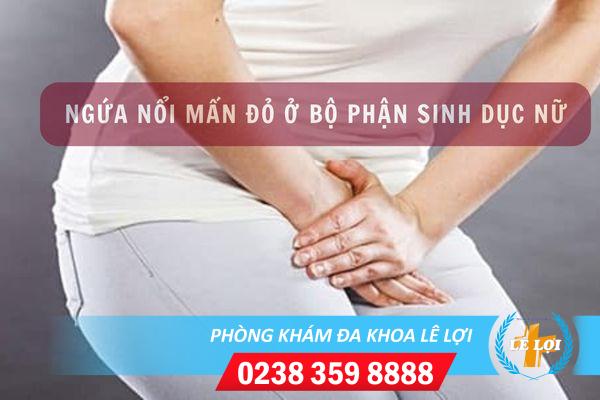 Ngứa nổi mẩn đỏ ở bộ phận sinh dục nữ là do đâu?