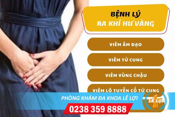 Ra Khí Hư Màu Vàng Có Nguy Hiểm Không