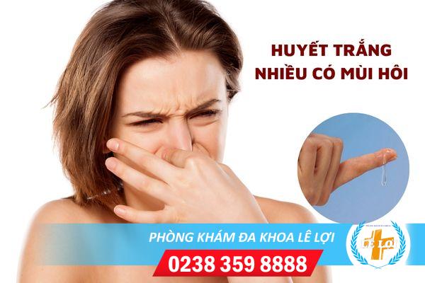 Huyết trắng ra nhiều và hôi là bị bệnh gì?