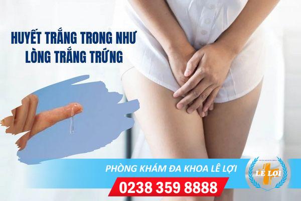 Một số lưu ý khi huyết trắng ra nhiều như lòng trắng trứng