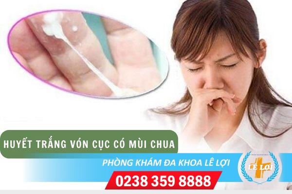 Huyết trắng vón cục có mùi chua và những bệnh lý liên quan