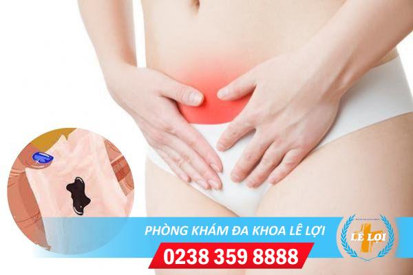 Khí Hư Có Màu Đen Là Biểu Hiện Của Bệnh Gì