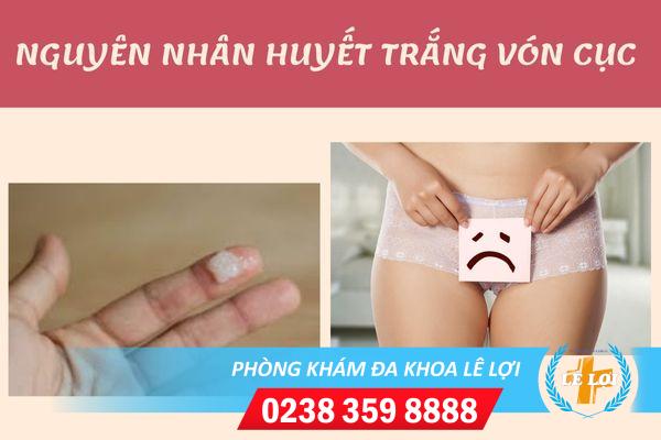 Địa chỉ điều trị ngứa vùng kín dịch trắng vón cục