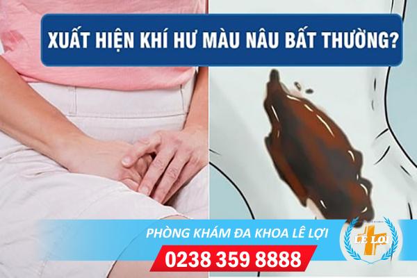 Cảnh Giác Với Triệu Chứng Khí Hư Màu Nâu