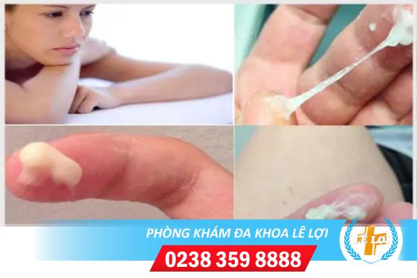 Những nguyên nhân của hiện tượng huyết trắng đục không mùi